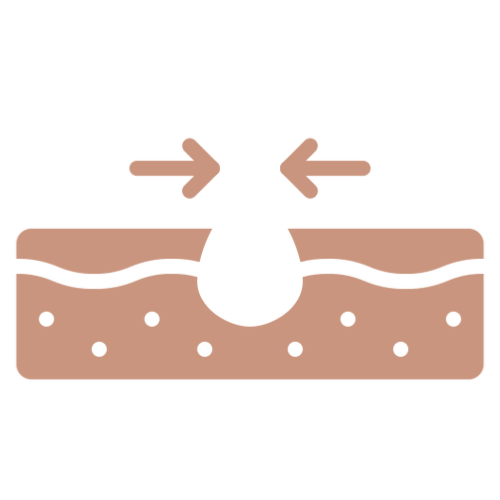 uneven-.png